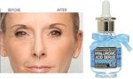 hyaluronic-Acid.jpg