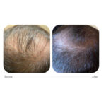 hairboos-2.jpg