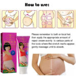 Stretch-Marks-Remover-Cream.jpg