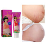 Stretch-Marks-Remover-Cream.jpg