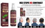 greyhair-treatment.jpg