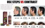 greyhair-treatment.jpg