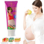 Stretch-Marks-Remover-Cream.jpg