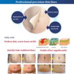 Stretch-Marks-Remover-Cream.jpg